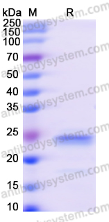 Recombinant Human ARL3 Protein, N-His