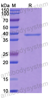 Recombinant Human PPP1CC Protein, N-His