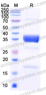Recombinant Human PPP1CC Protein, N-His & C-His