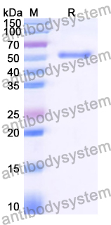 Recombinant Human CD135/FLT3 Protein, N-His