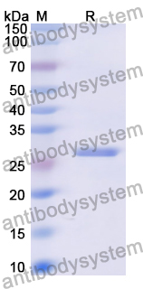 Recombinant Human DLST/OGDC-E2 Protein, N-His