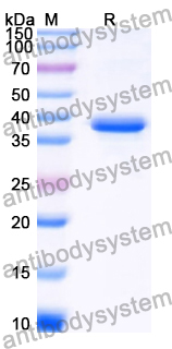 Recombinant Human DLST/OGDC-E2 Protein, N-His-KSI