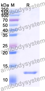 Recombinant Human ACVRL1/ALK-1 Protein, C-His