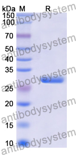 Recombinant Human SRP14 Protein, N-His-SUMO & C-Strep