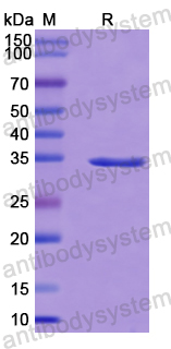 Recombinant Human ZEB1 Protein, N-GST & C-His
