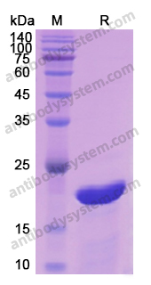 Recombinant Human SNCA Protein, N-His