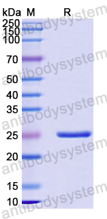 Recombinant Human IFNGR2 Protein, N-His