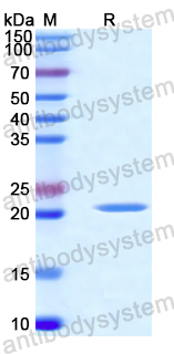 Recombinant Human ATP6V1A Protein, N-His