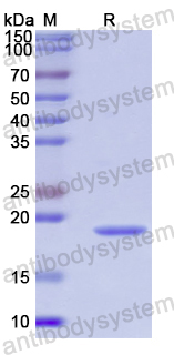 Recombinant Human RPS19 Protein, N-His
