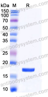 Recombinant Human RPS19 Protein, Tag free