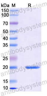 Recombinant Human MMP12 Protein, N-His