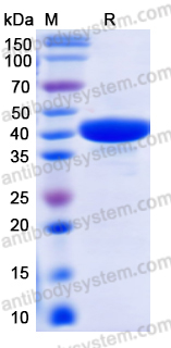 Recombinant Human CAPG Protein, N-His