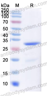 Recombinant Human DCT Protein, N-His