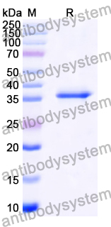 Recombinant Human ADCY8 Protein, N-His