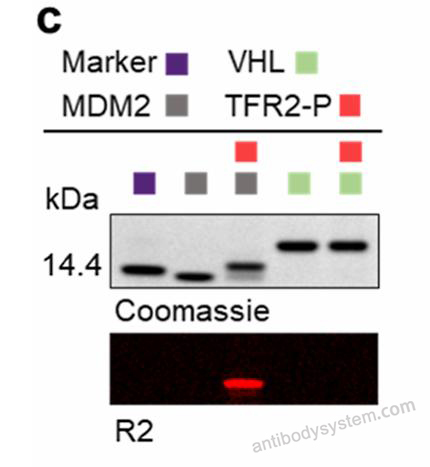 SDS-PAGE for Recombinant Human VHL Protein, N-His ?>