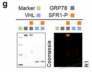 SDS-PAGE for Recombinant Human VHL Protein, N-His ?>