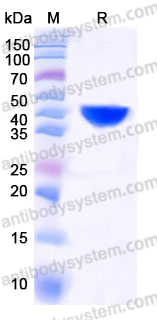 Recombinant Human MDH1 Protein, C-His