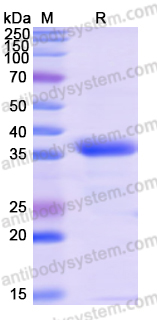 Recombinant Human MDH2 Protein, N-His