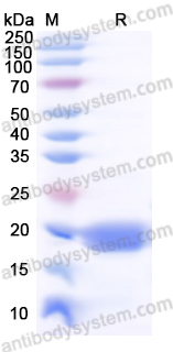 Recombinant Human AQP2 Protein, N-His-SUMO