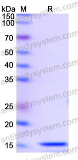 Recombinant Human EIF2D Protein, N-His