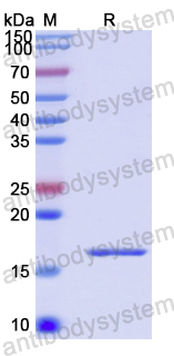 Recombinant Human RGS2 Protein, N-His