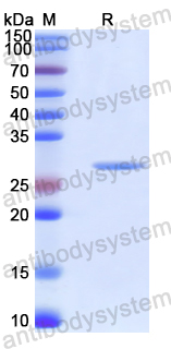 Recombinant Human KDM5C Protein, N-His