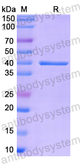 Recombinant Human AKR1C3 Protein, N-His