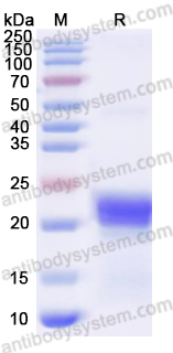 Recombinant Human CXCL5/ENA-78 Protein, N-His-SUMO