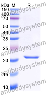 Recombinant Human PTGER3 Protein, N-His-KSI