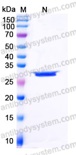 Recombinant Human CA7 Protein, C-His