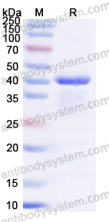 Recombinant Human NR4A2 Protein, N-His
