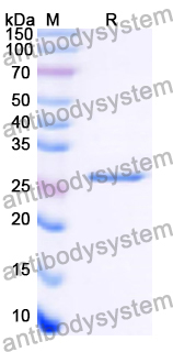Recombinant Human MAGEA6 Protein, N-His