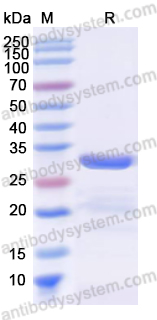 Recombinant Human TNNT2 Protein, N-His