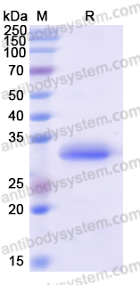Recombinant Human VDAC2 Protein, N-His
