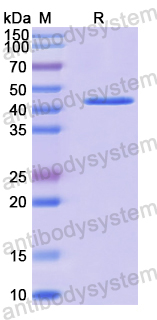 Recombinant Human ACADSB Protein, N-His