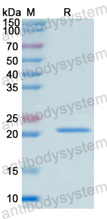 Recombinant Human CBX5 Protein, N-His-SUMO