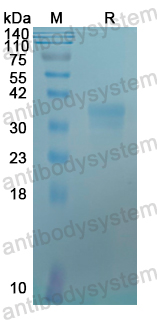 Recombinant Human USP5 Protein, C-His