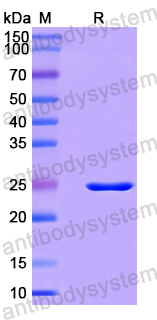 Recombinant Human RPL5 Protein, N-His