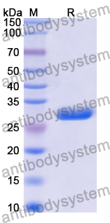 Recombinant Human STT3A Protein, N-His