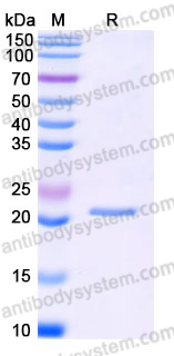 Recombinant Human EIF1AX Protein, N-His