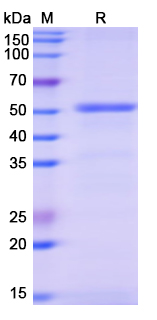Recombinant Human ALDH1A3 Protein, N-His