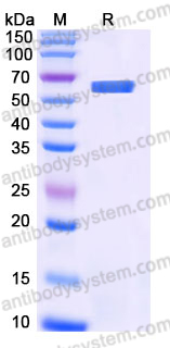 Recombinant Human ALDH1A3 Protein, N-His