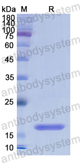 Recombinant Human LGALS7 Protein, N-His