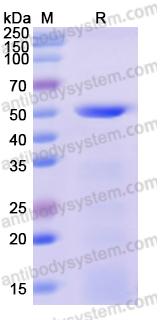 Recombinant Human ME1 Protein, N-His