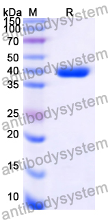 Recombinant Human SOX9, N-GST & C-His