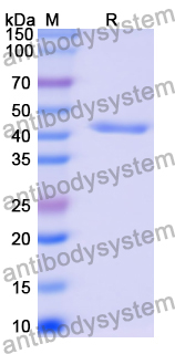 Recombinant Human CD151 Protein, N-GST & C-His