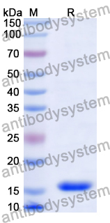 Recombinant Human GIPR/GIP-R Protein, N-His