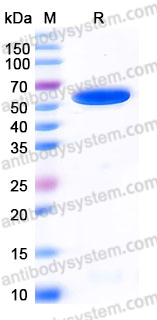 Recombinant Human GSS Protein, C-His