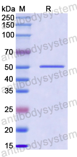 Recombinant Human HSPA13 Protein, N-His