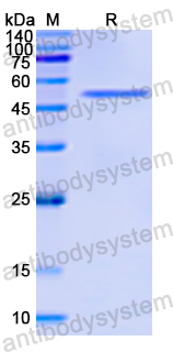 Recombinant Human MASP1 Protein, N-His